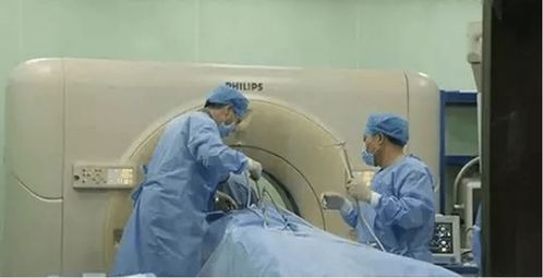 康博刀,最具性價比的治療選擇