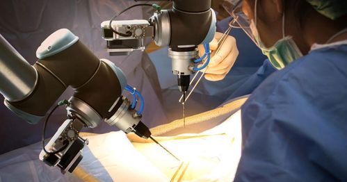 醫(yī)療器械開(kāi)發(fā)的自動(dòng)化浪潮 驅(qū)動(dòng)大型醫(yī)療器械自動(dòng)化的核心原因